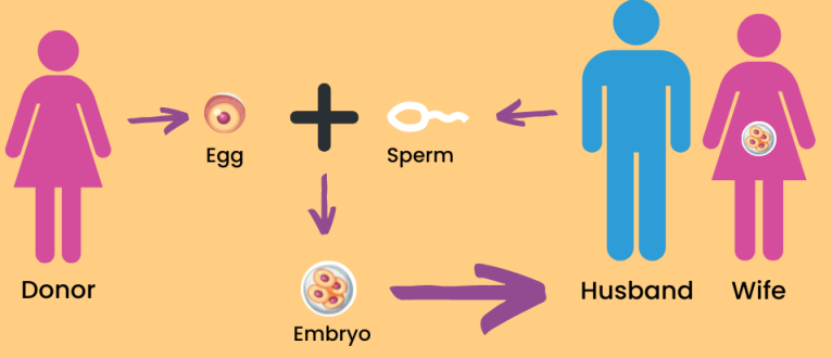 EGG Donation